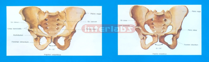 HUMAN FEMALE HEALTH PELVIS COMPARISON MODEL